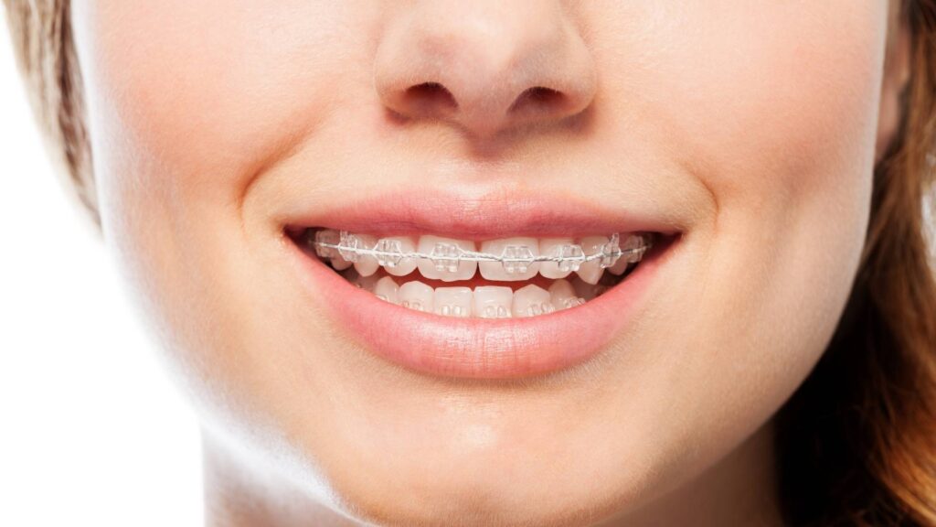 ortodoncia en honduras